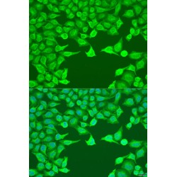 Autophagy Related 9A (ATG9A) Antibody