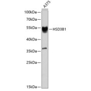 Western blot analysis of extracts of A-375 cells using HSD3B1 Antibody (1/1000 dilution).
