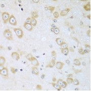 abx007121