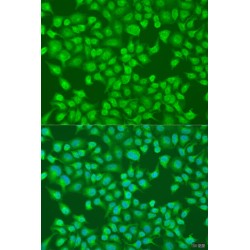 Acyl Coenzyme A Oxidase 1, Palmitoyl (ACOX1) Antibody