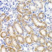 Immunohistochemistry of paraffin-embedded Rat kidney using HMGCL Antibody (1/100 dilution, 40x lens).