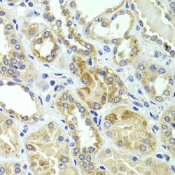 Hydroxymethylglutaryl-CoA Lyase, Mitochondrial (HMGCL) Antibody
