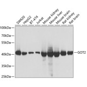 Western blot analysis of extracts of various cell lines using GOT2 Antibody (1/1000 dilution).