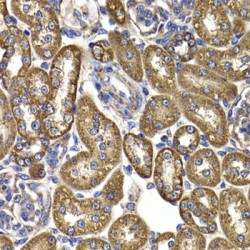 Aspartate Aminotransferase, Mitochondrial / AST (GOT2) Antibody