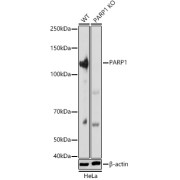Western blot analysis of extracts from wild type(WT) and PARP1 knockout (KO) HeLa cells, using PARP1 Antibody (1/5000 dilution).