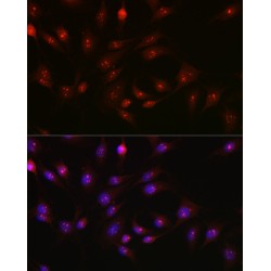 Poly ADP-Ribose Polymerase 1 (PARP1) Antibody