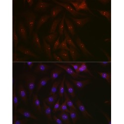 Poly ADP-Ribose Polymerase 1 (PARP1) Antibody