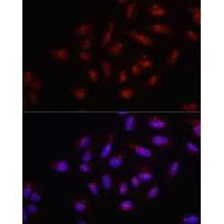 Poly ADP-Ribose Polymerase 1 (PARP1) Antibody