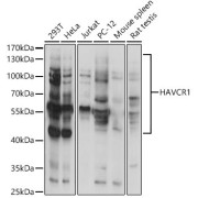 Western blot analysis of extracts of various cell lines using HAVCR1 Antibody (1/1000 dilution).