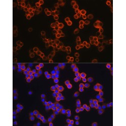 Toll Like Receptor 4 (TLR4) Antibody
