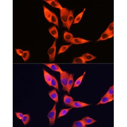 Toll Like Receptor 4 (TLR4) Antibody