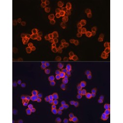 Toll Like Receptor 4 (TLR4) Antibody