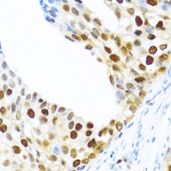 KH Domain-Containing, RNA-Binding, Signal Transduction-Associated Protein 2 (KHDRBS2) Antibody