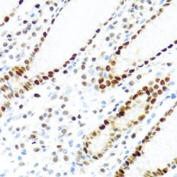 KH Domain-Containing, RNA-Binding, Signal Transduction-Associated Protein 2 (KHDRBS2) Antibody