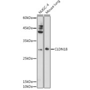 Western blot analysis of extracts of various cell lines using CLDN18 Antibody (1/1000 dilution).