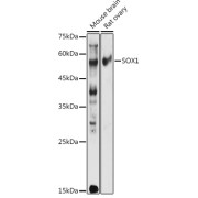 WB analysis of Mouse brain and Rat ovary cell lysates using Transcription Factor SOX-1 (SOX1) antibody (1/1000 dilution). Calculated MW: 50 kDa, Observed MW: 39 kDa.