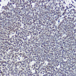 Transcription Factor SOX-1 (SOX1) Antibody