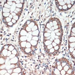 Adenomatous Polyposis Coli Protein (APC) Antibody