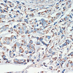 Adenomatous Polyposis Coli Protein (APC) Antibody