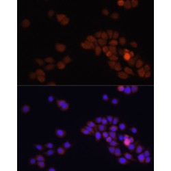 Adenomatous Polyposis Coli Protein (APC) Antibody