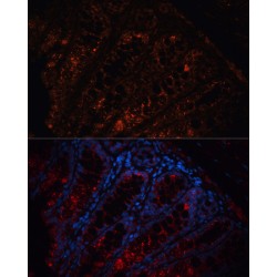 Adenomatous Polyposis Coli Protein (APC) Antibody
