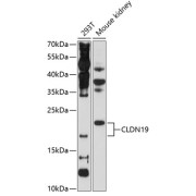 Western blot analysis of extracts of various cell lines using CLDN19 Antibody (1/1000 dilution).