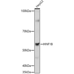 Hepatocyte Nuclear Factor 1-Beta (HNF1B) Antibody