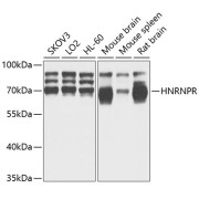 Western blot analysis of extracts of various cell lines using HNRNPR Antibody (1/1000 dilution).