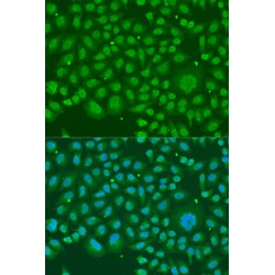 Heterogeneous Nuclear Ribonucleoprotein R (HNRNPR) Antibody