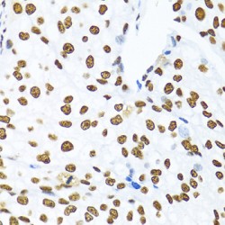 GAP-Associated Tyrosine Phosphoprotein P62 (KHDRBS1) Antibody