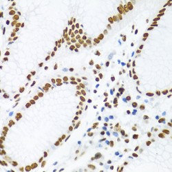 GAP-Associated Tyrosine Phosphoprotein P62 (KHDRBS1) Antibody