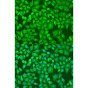 Immunofluorescence analysis of U2OS cells using DVL2 Antibody (1/100 dilution). Blue: DAPI for nuclear staining.