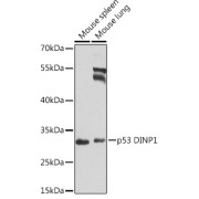 Western blot analysis of extracts of various cell lines using p53 DINP1 Antibody (1/1000 dilution).