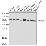 Western blot analysis of extracts of various cell lines using RSPO3 Antibody (1/1000 dilution).