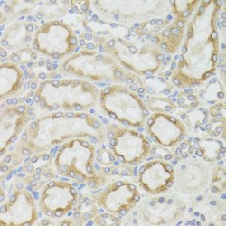 NADH Dehydrogenase 5 (ND5) Antibody