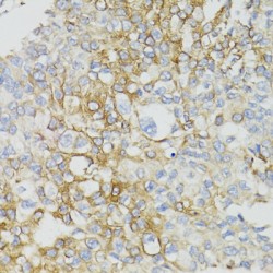 NADH Dehydrogenase 5 (ND5) Antibody