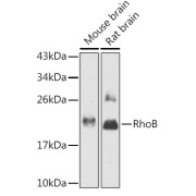 Western blot analysis of extracts of various cell lines using RhoB Antibody (1/1000 dilution).