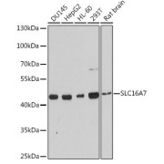 Western blot analysis of extracts of various cell lines using SLC16A7 Antibody (1/3000 dilution).