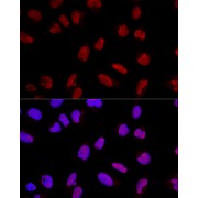 Confocal immunofluorescence analysis of U2OS cells using AKAP8 Antibody (1/200 dilution). Blue: DAPI for nuclear staining.