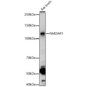 Western blot analysis of Rat brain using NMDAR1 Antibody (1/2000 dilution).