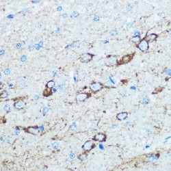 Glutamate Receptor Ionotropic, NMDA 1 (GRIN1) Antibody