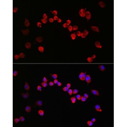 Glutamate Receptor Ionotropic, NMDA 1 (GRIN1) Antibody