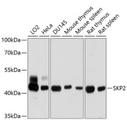 Western blot analysis of extracts of various cell lines using SKP2 Antibody (1/1000 dilution).
