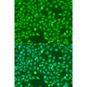 Immunofluorescence analysis of U2OS cells using MEF2A Antibody (1/100 dilution). Blue: DAPI for nuclear staining.