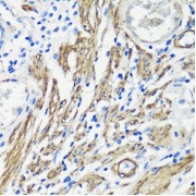 Immunohistochemistry of paraffin-embedded Human colon muscle using FLNA Antibody (1/100 dilution, 40x lens).