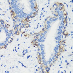 Filamin-A (FLNA) Antibody