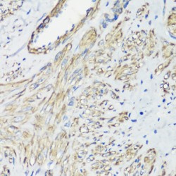 Filamin-A (FLNA) Antibody