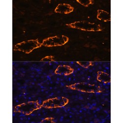 Aquaporin 3 (AQP3) Antibody