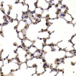 Thioredoxin (TXN) Antibody