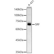 Western blot analysis of A-431 using SRF Antibody (1/1000 dilution).